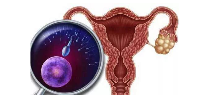 揭开子宫肌瘤的神秘面纱：女性健康必修课